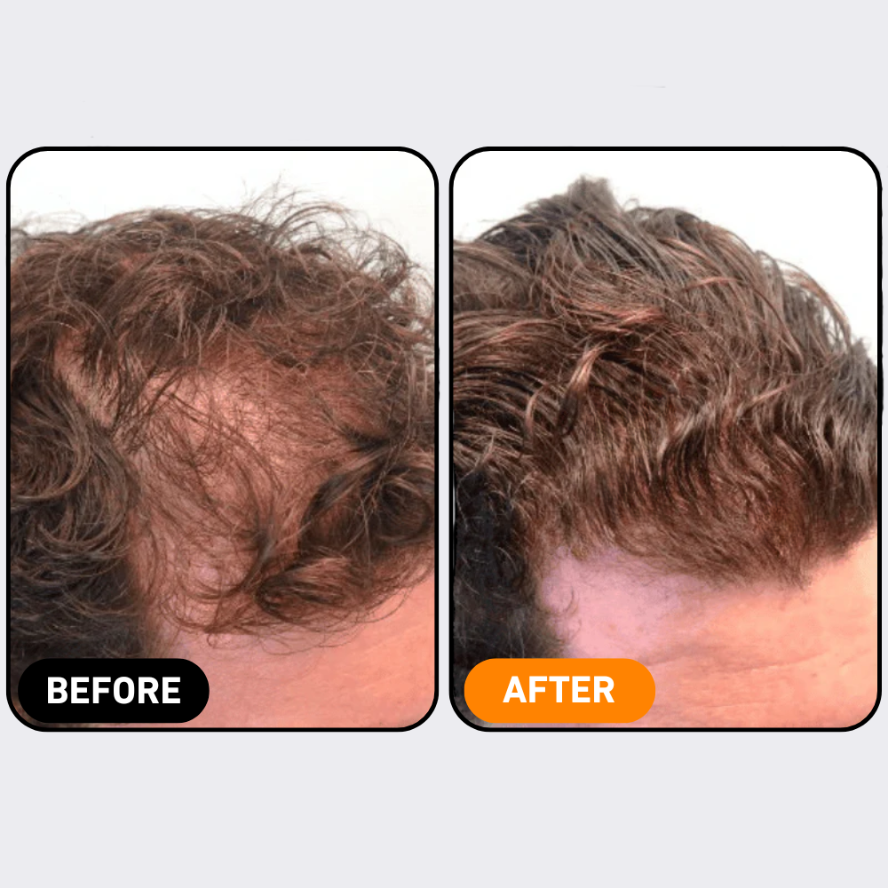 Hair Growth Formula | 100% Natural