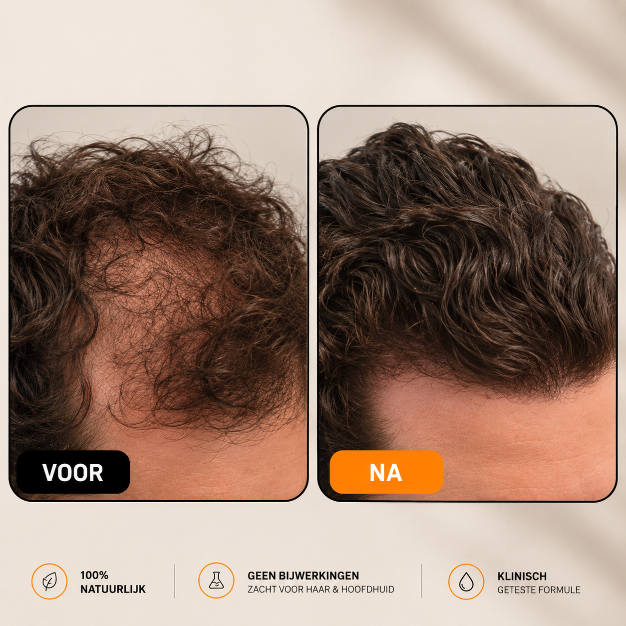 Root Activating Shampoo