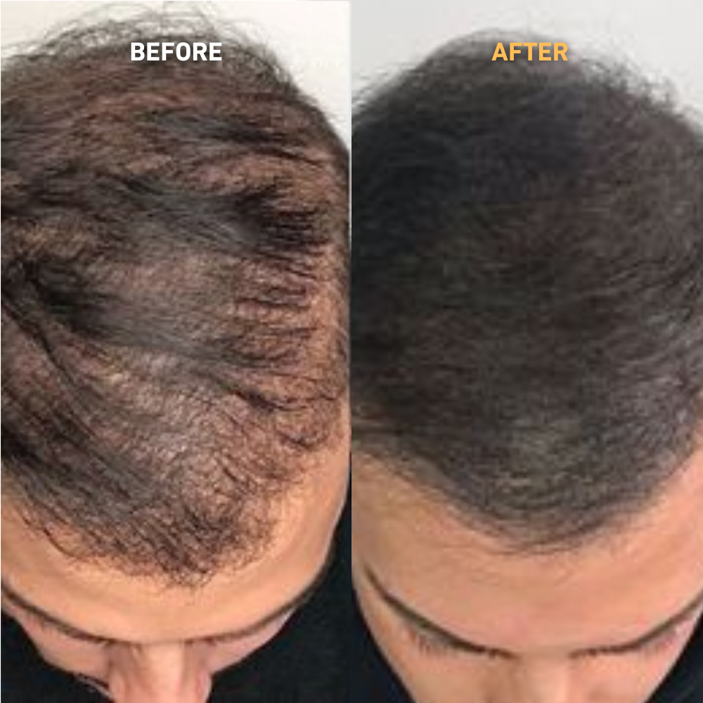 100% Reines Batana-Öl ~ Das Geheimnis für optimales Haarwachstum