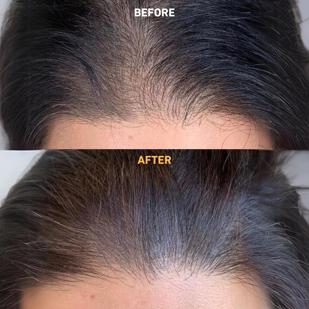 100% Reines Batana-Öl ~ Das Geheimnis für optimales Haarwachstum