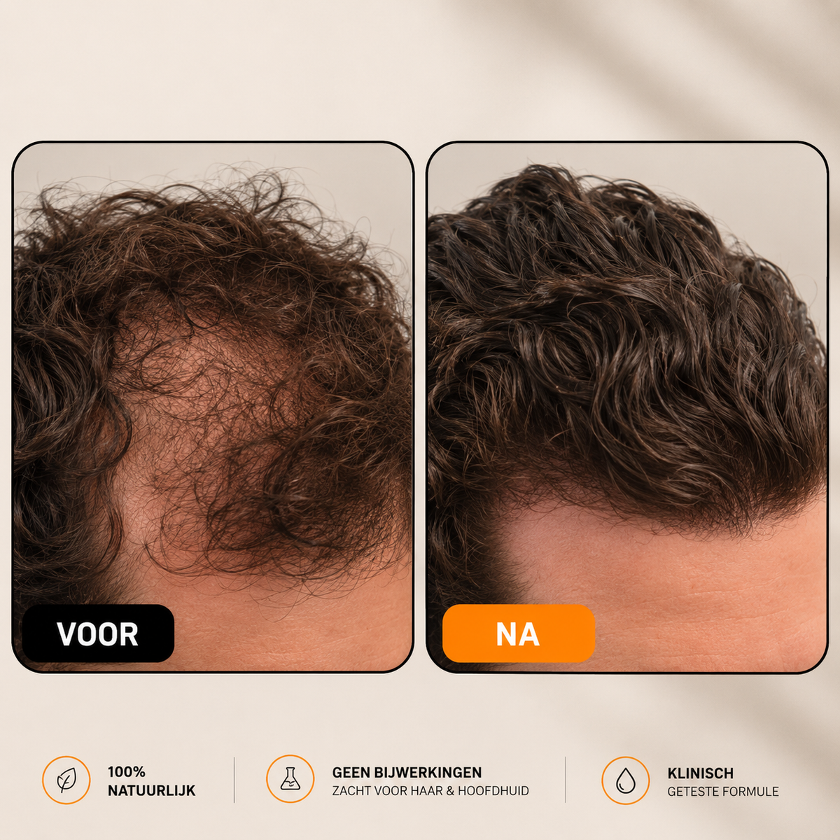 Root Activating Shampoo